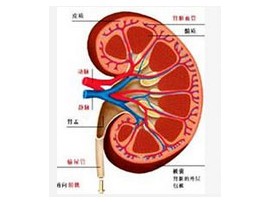 肾结石的症状有那些?